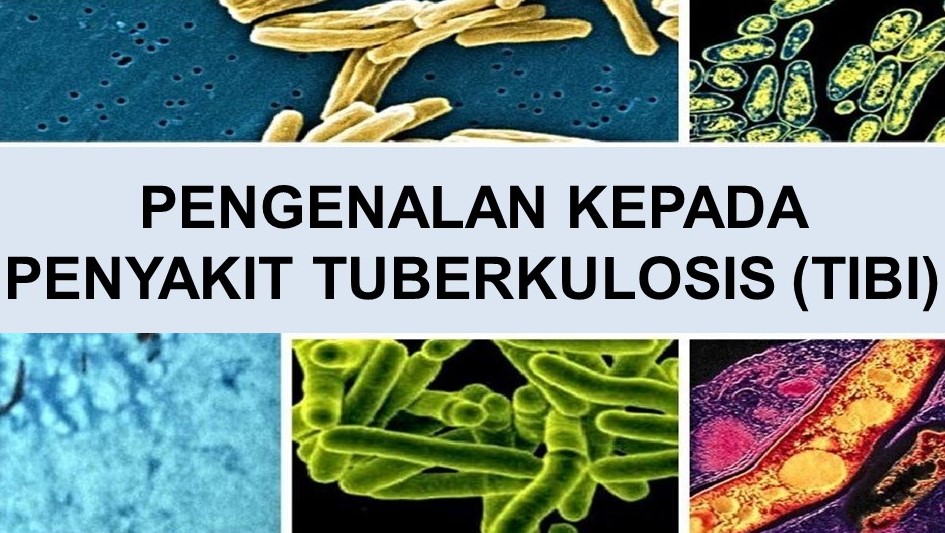 Pengenalan Kepada Penyakit Tuberkulosis (Tibi)